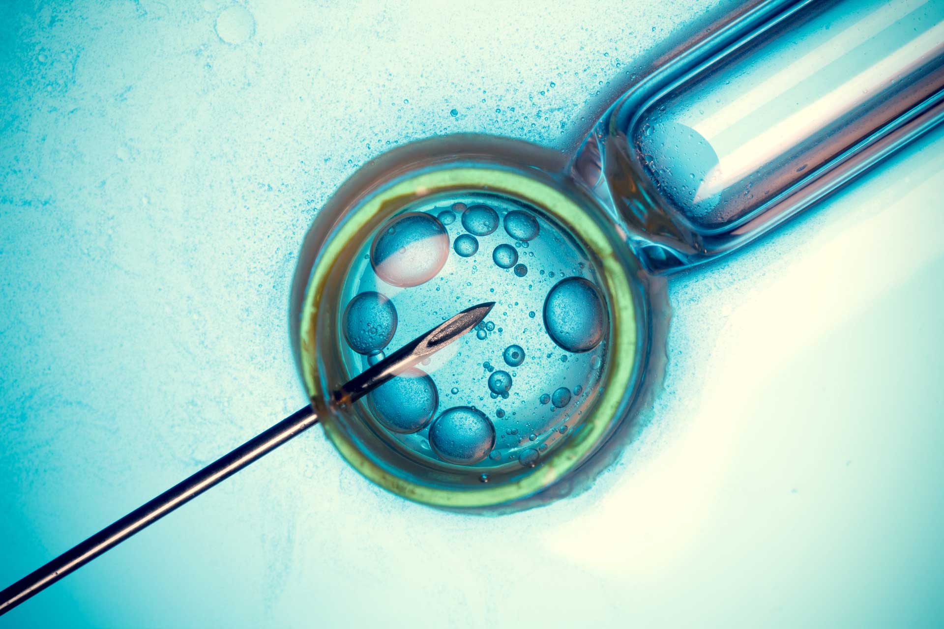 Buy Vitrolife on long-term fertility trends