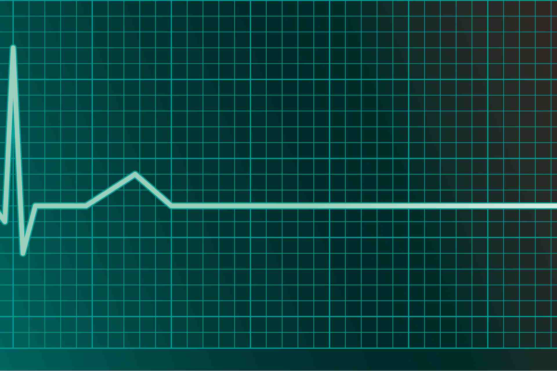FX in doldrums as fear factor spikes